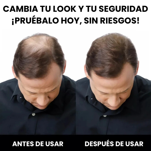 Kit Fibras Capilares Toppik + Ebook – Cabello más lleno al instante, sin cirugía ni químicos