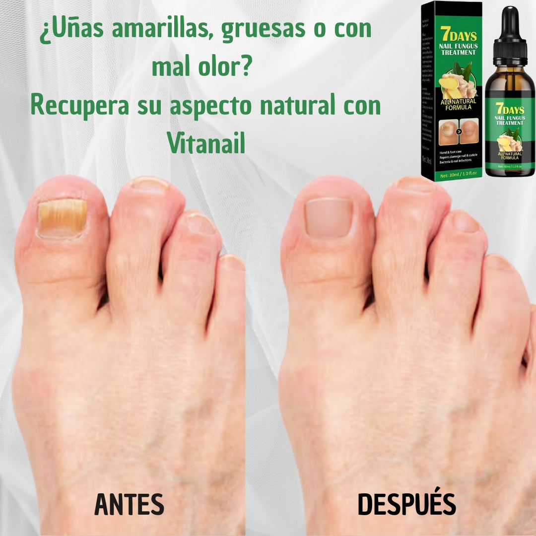 Aceite Vitanail - Recupera tus uñas en 7 días