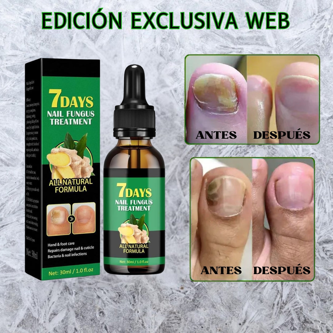Aceite Vitanail - Recupera tus uñas en 7 días