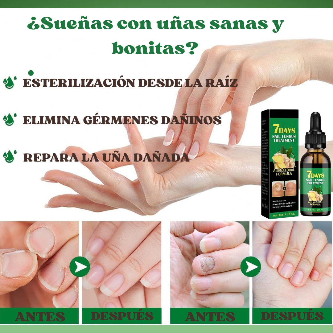 Aceite Vitanail - Recupera tus uñas en 7 días
